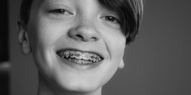 What skincare should preteens use to care for their changing skin?